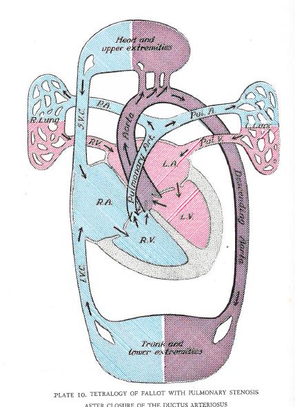 Congenital Malformations of