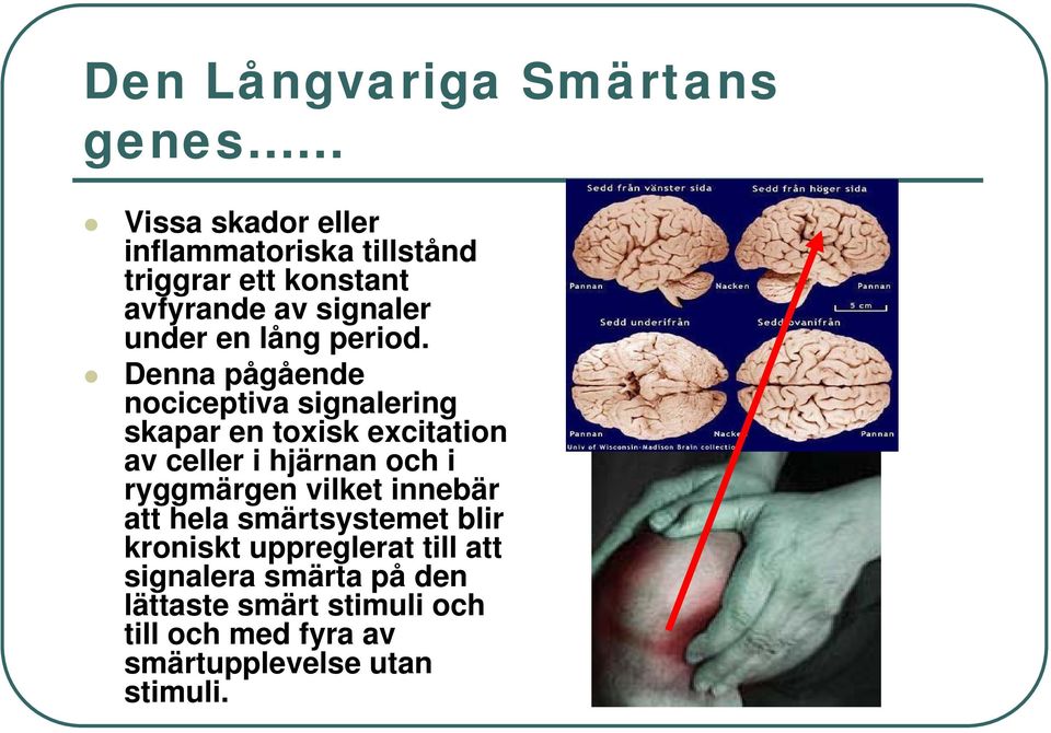 Denna pågående nociceptiva signalering skapar en toxisk excitation av celler i hjärnan och i ryggmärgen