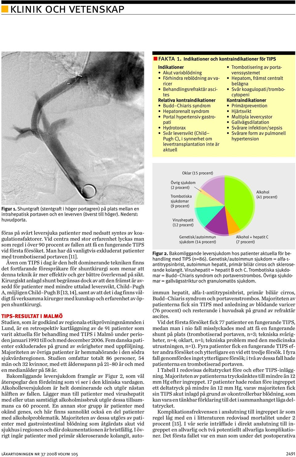 syndrom Portal hypertensiv gastropati Hydrotorax Svår leversvikt (Child Pugh C), i synnerhet om levertransplantation inte är aktuell Trombotisering av portavenssystemet Hepatom, främst centralt