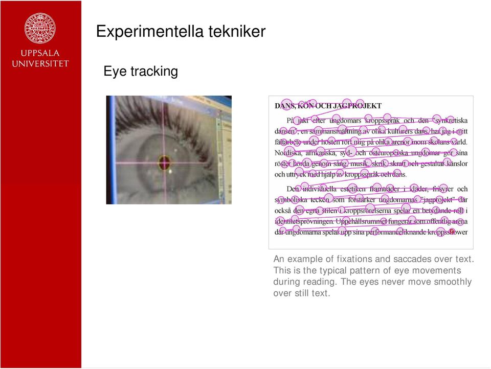 This is the typical pattern of eye movements