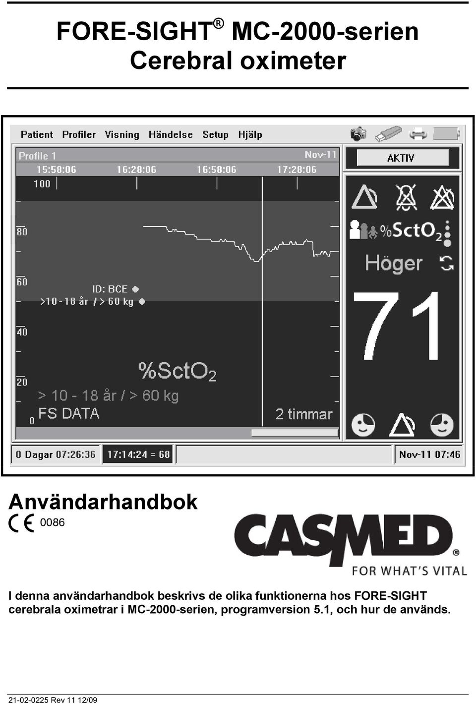 funktionerna hos FORE-SIGHT cerebrala oximetrar i