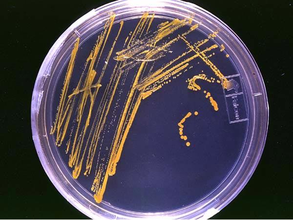 Hur studerar man bakterier bäst?