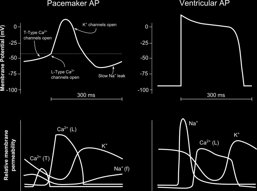 sist 3) kalciumkanaler (grön) för att ge en sista depolarisation innan aktionspotentialen. Dessa kalciumkanaler har lite snabbare kinetik Transient type (T-type).