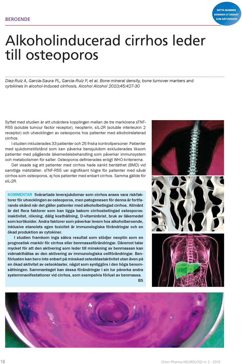 och utvecklingen av osteoporos hos patienter med alkoholrelaterad cirrhos. I studien inkluderades 33 patienter och 25 friska kontrollpersoner.