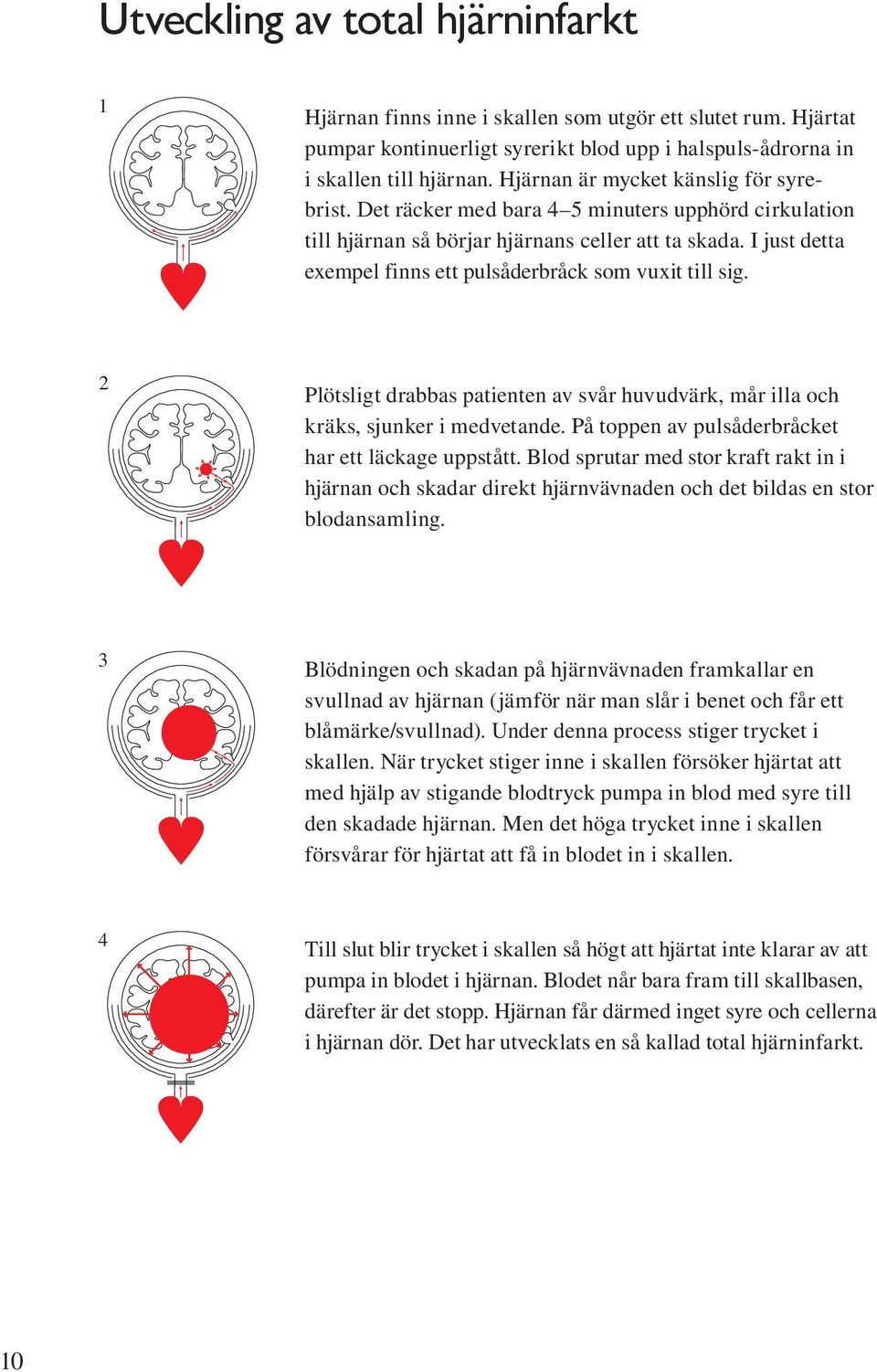 I just detta exempel finns ett pulsåderbråck som vuxit till sig. Hjärnan förvaras inne i skallen ett slutet rum.