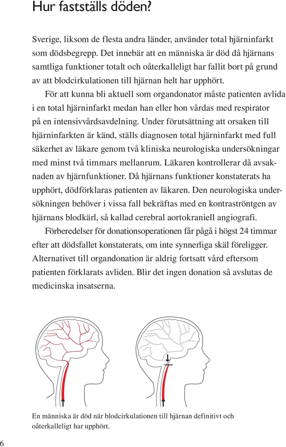 För att kunna bli aktuell som organdonator måste patienten avlida i en total hjärninfarkt medan han eller hon vårdas med respirator på en intensivvårdsavdelning.