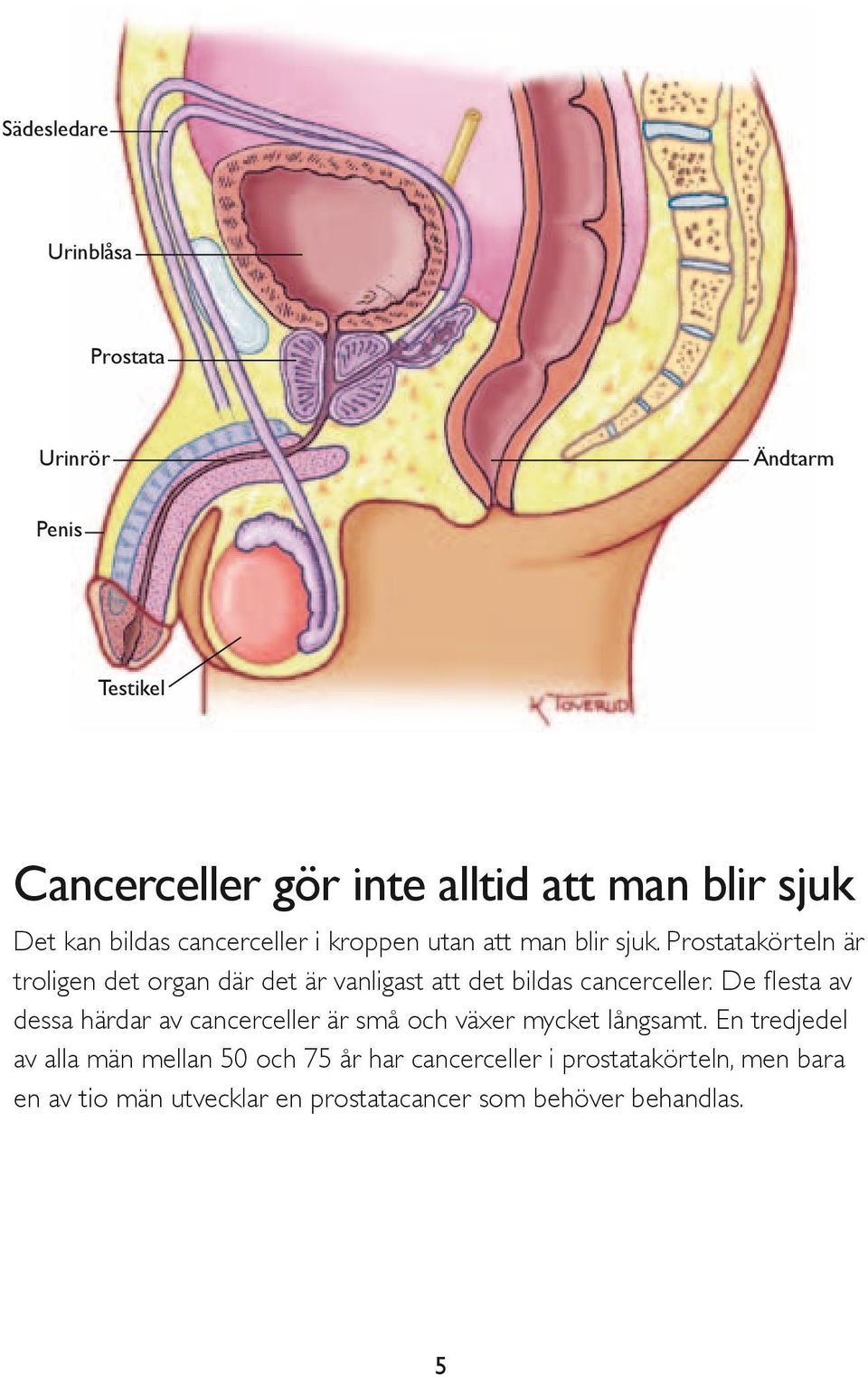 Prostatakörteln är troligen det organ där det är vanligast att det bildas cancerceller.