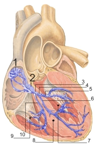 5 Abberant ledningsbana Re-entry kan också uppstå i en anatomisk variant av ledningsbanor mellan förmak och kammare.