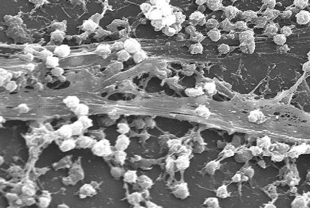 Biofilmer Samhälle av mikroorganismer och extracellulära produkter Utbyte av närings-, spårämnen Skydd mot