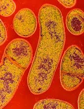 BOTULISM Botulism är en förgiftning som är obotlig och giftet produceras av en bakterie som heter Clostridium botulinum.