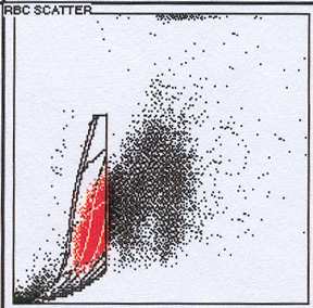 Figur 3. Cytogram från Advia 2120. De röda punkterna inom rutmönstret är erytrocyter och de svarta punkterna till vänster om rutmönstret är trombocyter.