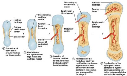 utför benförlängningar (callus distraction) MEN: 1. Direkt benläkning 2. Enkondral benläkning - läkning med callus 1 mm om dagen upp till ca 5-6 cm (risk för mjukdelsproblem sedan).