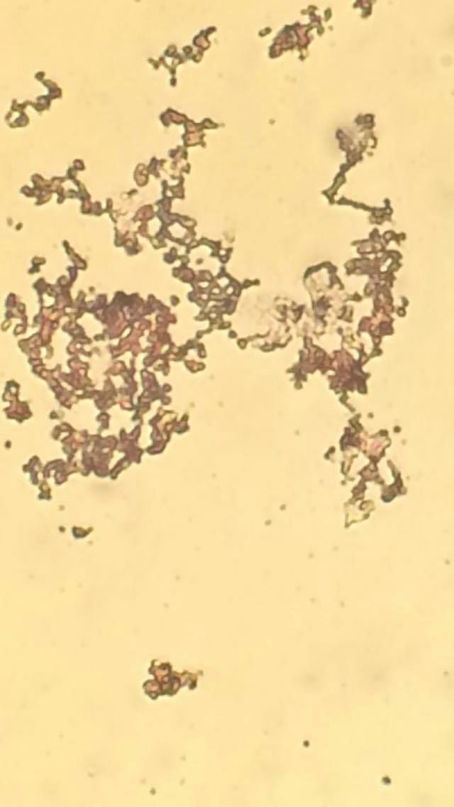 Figur 2a: Bakterien X uttrycker en rosa färg, Figur 2b : L.rhamnosus LB21 erhåller en blandning vilket antyder att den är gram negativ. av rosa och blå färg, lilaliknande färg.