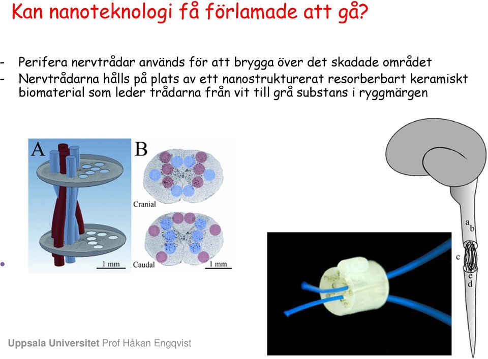 Nervtrådarna hålls på plats av ett nanostrukturerat resorberbart