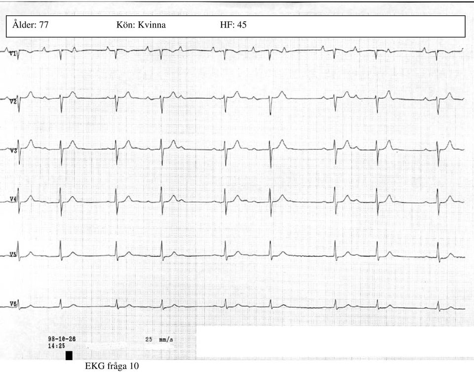 Kvinna HF: