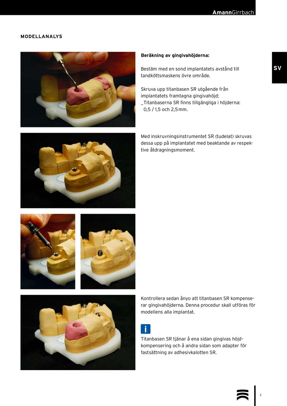 Med inskruvningsinstrumentet SR (tudelat) skruvas dessa upp på implantatet med beaktande av respektive åtdragningsmoment.