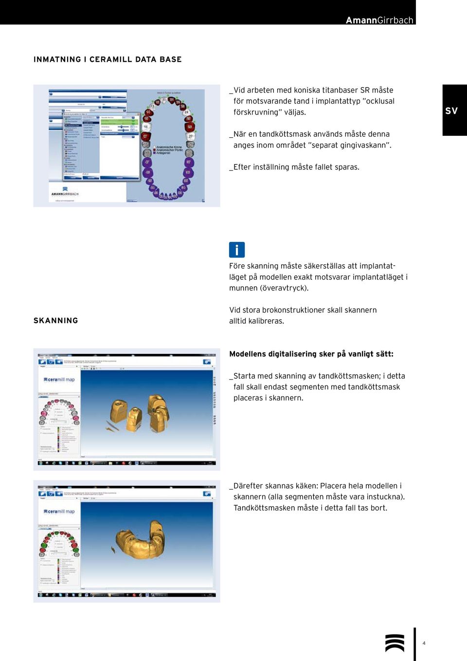 Före skanning måste säkerställas att implantatläget på modellen exakt motsvarar implantatläget i munnen (överavtryck). SKANNING Vid stora brokonstruktioner skall skannern alltid kalibreras.