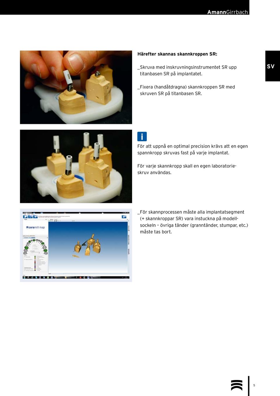 För att uppnå en optimal precision krävs att en egen spannkropp skruvas fast på varje implantat.