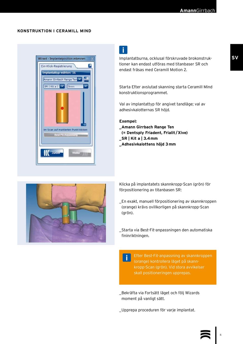 Exempel: _ Amann Girrbach Range Ten (= Dentsply Friadent, Frialit / Xive) _ SR Kit a 3.