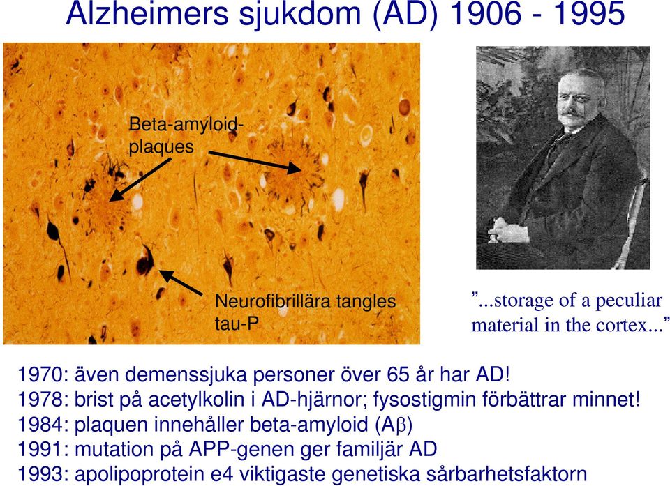 1978: brist på acetylkolin i AD-hjärnor; fysostigmin förbättrar minnet!