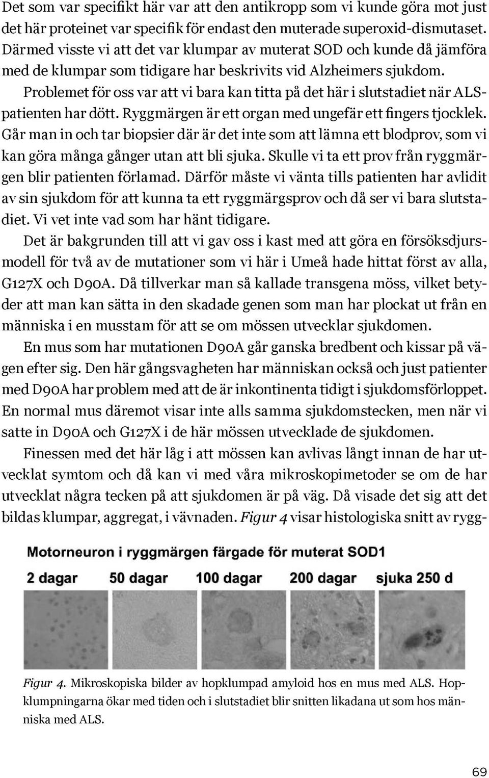 Problemet för oss var att vi bara kan titta på det här i slutstadiet när ALSpatienten har dött. Ryggmärgen är ett organ med ungefär ett fingers tjocklek.