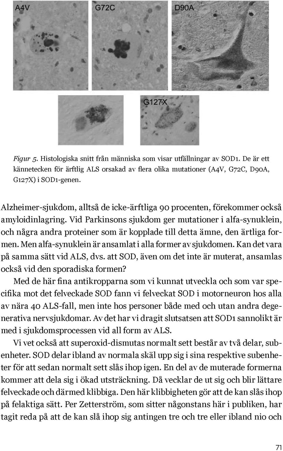 Vid Parkinsons sjukdom ger mutationer i alfa-synuklein, och några andra proteiner som är kopplade till detta ämne, den ärtliga formen. Men alfa-synuklein är ansamlat i alla former av sjukdomen.