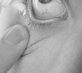 Antihistaminer Kortison sprayer Fördel Idag biverkningsfritt Snabb effekt Effekt ögon och näsa urtikaria/klåda i Nackdel Måttlig effekt Rätt spray teknik är viktig så man undviker Natriumkromoglikat-
