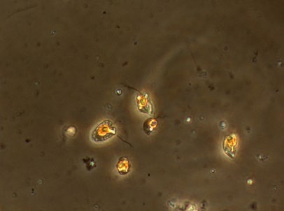 FIGUR 4. Exempel på vanligt förekommande växtplankton i Öresund under 2015.