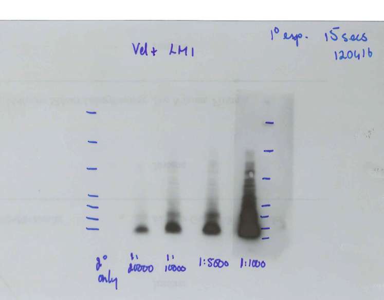 KDa Std 1:50000 1:20000 1:10000 1:5000 Vel+ Vel Vel Vel Vel+ Polyklonala kanin-antikroppar 4 peptider syntetiserades mot den extracellulära delen Inhiberingsförsök Polyklonala