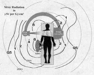 ICRP 85 Hirshfeld et al.