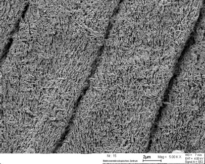 Dricksvatten innehållande >2 ppm fluor före 10-års ålder resulterar i dental fluoros.