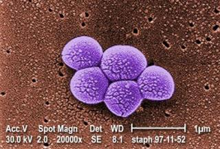 CC398 är en MRSA som koloniserar såväl svin som människa och ökat från 12 fall 2007 till 643 fall 2013.