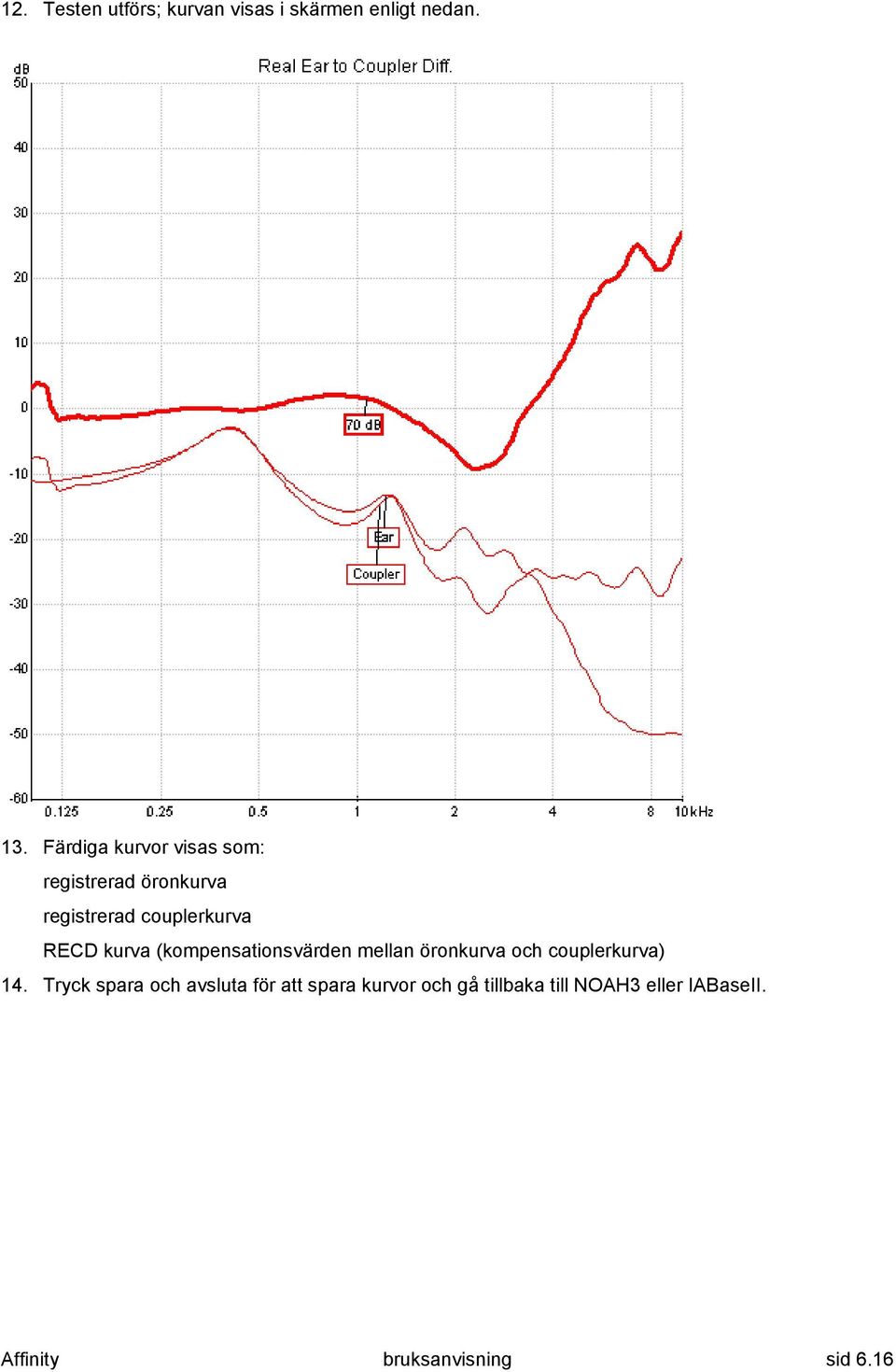 kurva (kompensationsvärden mellan öronkurva och couplerkurva) 14.