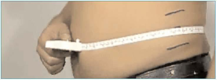 Så här mäter du midjemått Midjemått/bukomfång mäts i höjd med naveln, med ett vågrätt måttband: 1. Be patienten ta av sig på överkroppen. Markera en punkt mellan nedersta revbenet och höftkammen. 2.