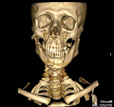 3D-rekonstruktioner numera