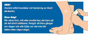 Skavsår Orsakas av nötning eller tryck. Sätt på en extra hud (skavsårsplåster/leukoplast). Om idrottaren har fått en blåsa, ta inte hål på den på grund av infektionsrisken.