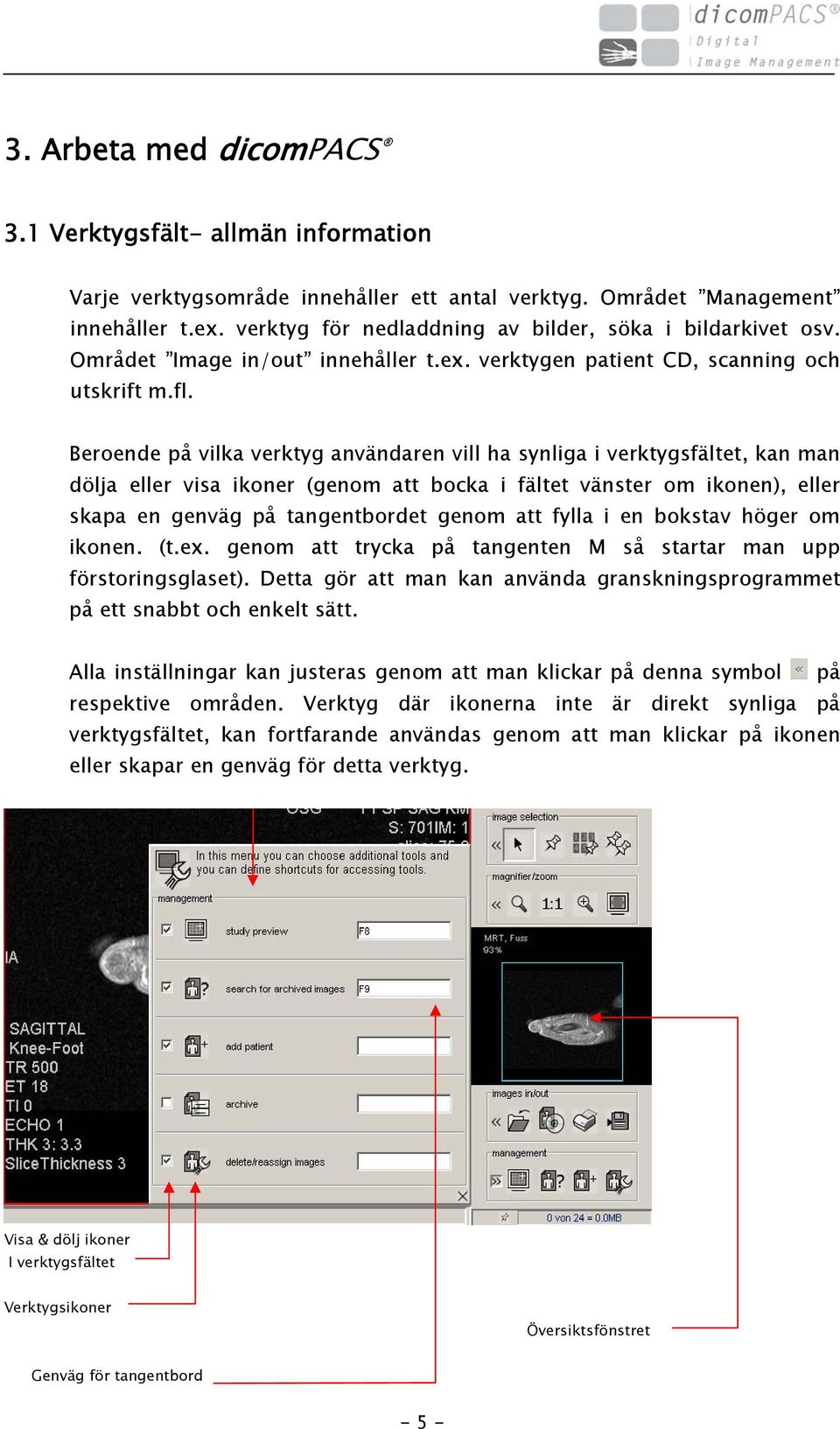 Beroende på vilka verktyg användaren vill ha synliga i verktygsfältet, kan man dölja eller visa ikoner (genom att bocka i fältet vänster om ikonen), eller skapa en genväg på tangentbordet genom att