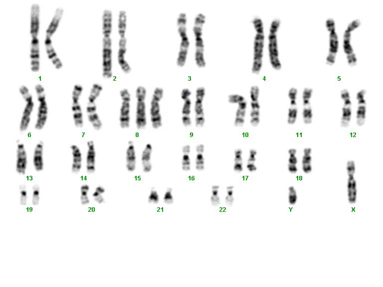 Exempel 1