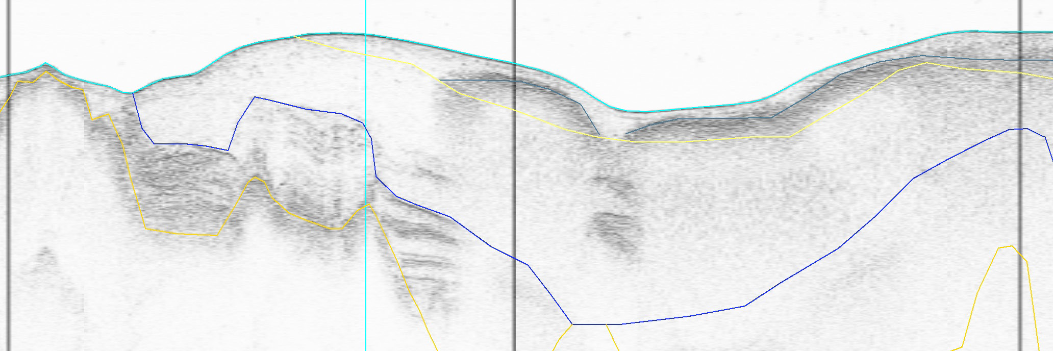 och där framgår det även om nytt förslag angetts för respektive område. I sjökortet visas även ungefärlig position för utsnitt av sedimentekolodsprofilerna. Dessa visas med blå eller grön linje.