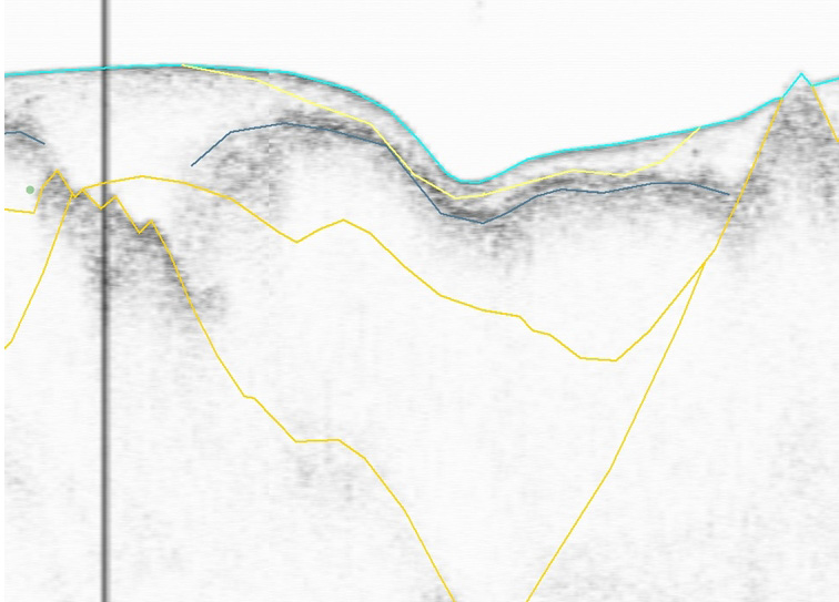 Figur 6. Sedimentekolodsprofil 07b_120. Provet 07b_011 visas med rött vertikalt streck. Ovanför den rosa linjen finns postglacial silt. Tabell 3.