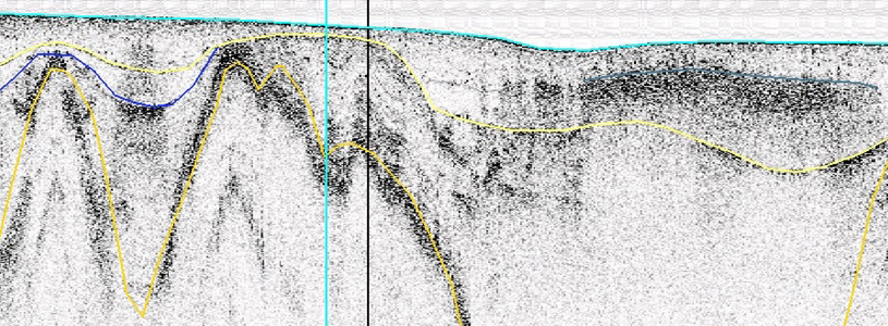 Figur 37. Sedimentekolodprofil 08b_003. Den postglaciala leran, ljusgul linje, överlagrar postglacial finlera som är något äldre. Tabell 16.