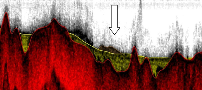 S N Figur 64. Sedimentekolod från mätlinje Nbk07_0312. Mätningen är utförd från arbetsbåt. Berg och glaciallera dominerar.