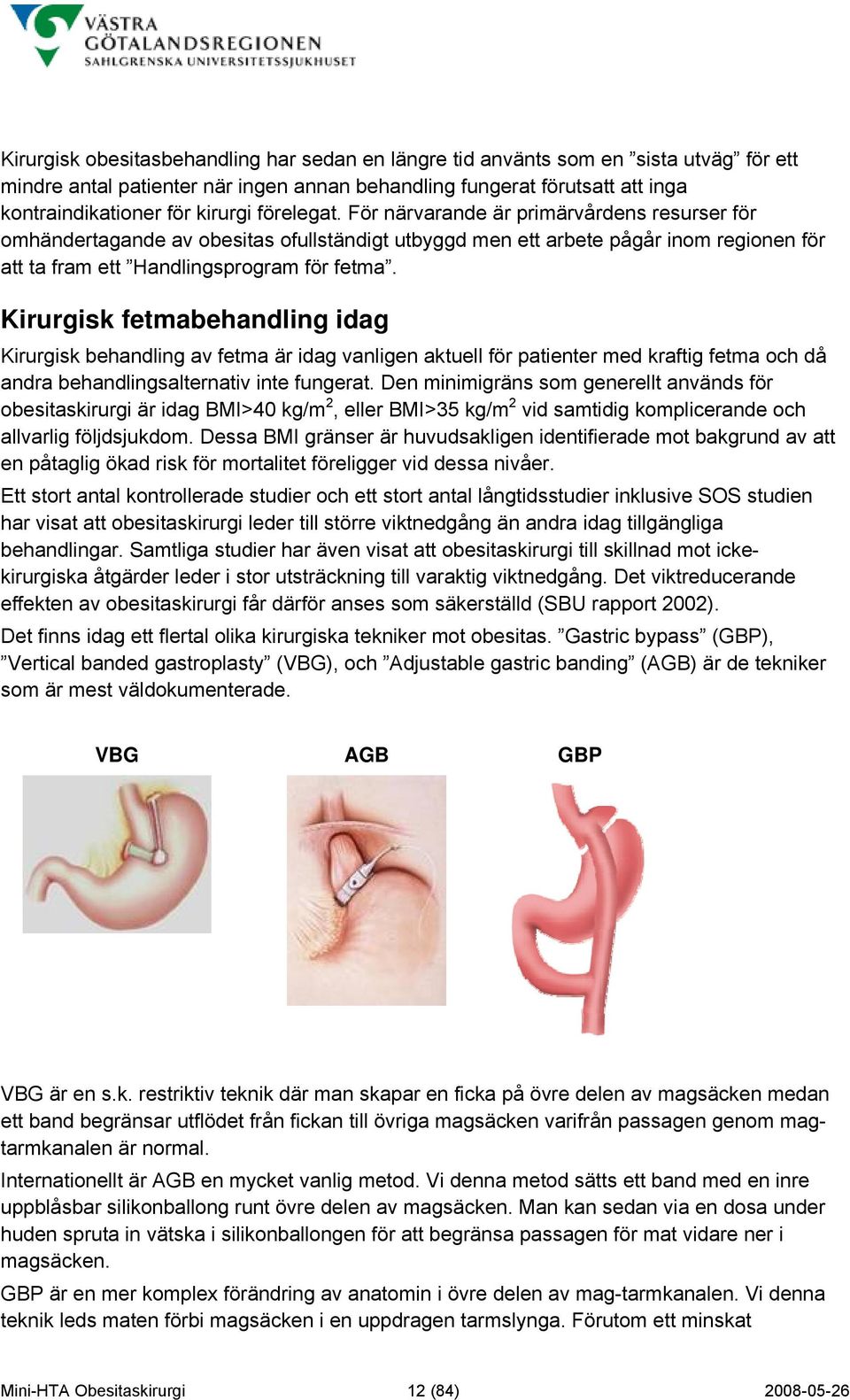 Kirurgisk fetmabehandling idag Kirurgisk behandling av fetma är idag vanligen aktuell för patienter med kraftig fetma och då andra behandlingsalternativ inte fungerat.