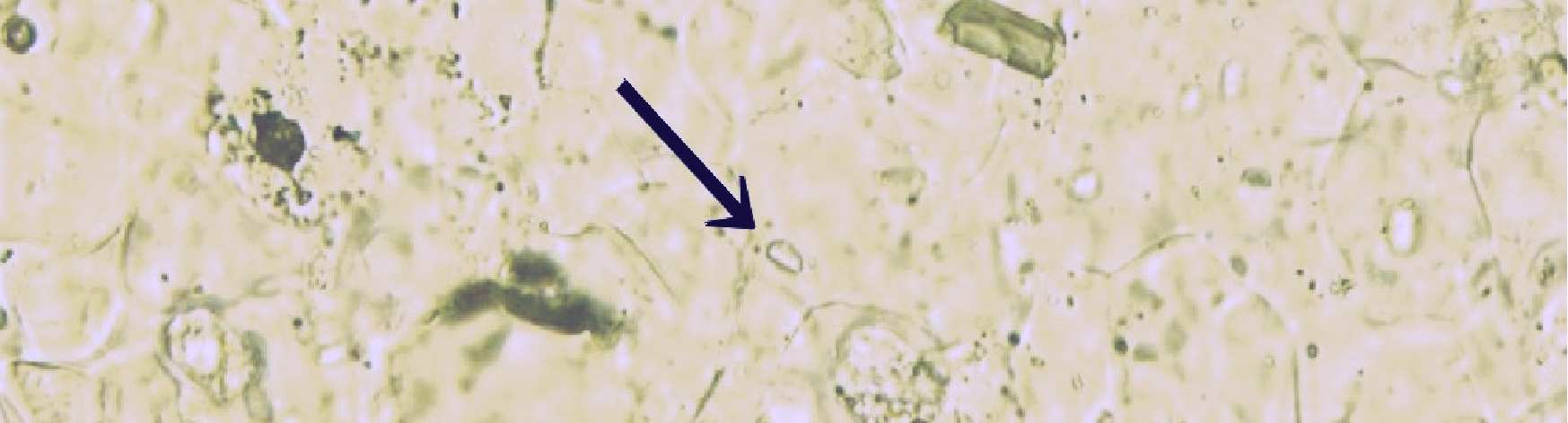 Fig. 20. Albit (kristaller med svart vita tvillinglameler).