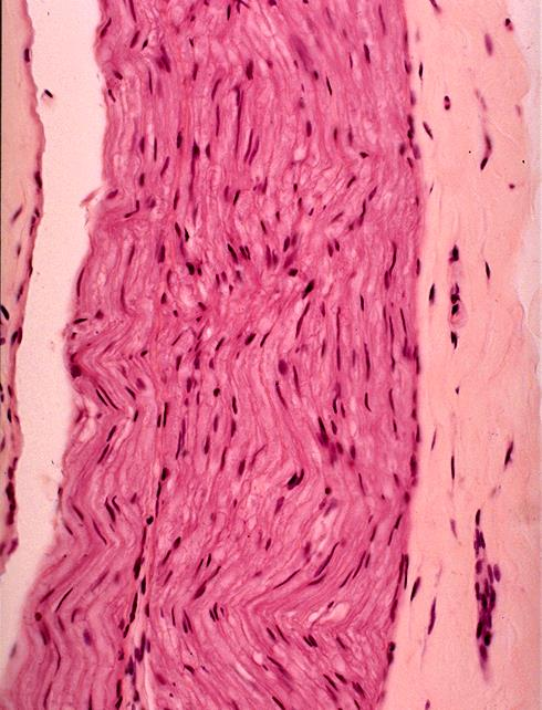 N1 Perifer nerv, Htx-eosin Tvärsnitt: Tre stycken (2 större och 1 mindre) alt två (större) tvärskurna nervbuntar ses omgivna av en ljusare färgad bindvävsskida (epineurium) med kollagena fibrer.