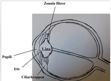 1 Introduktion 1.1 Ackommodation 1.1.1 Anatomi Iris är en rund, tunn struktur i ögat som är lokaliserad framför linsen.