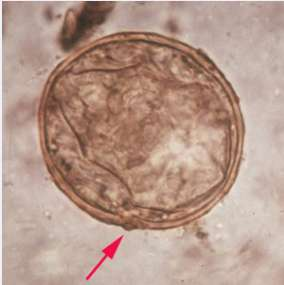 Parasitmorfologi UK Neqas Fecesparasiter sept 2014 feb 2015 Mån Prov Förväntat fynd Resultat Sep 3 1 2 Sep 30 1 2 Nov 1 2 Feb 1 2 Trofozoiter av Giardia intestinalis Dientamoeba fragilis och