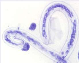 Parasitmorfologi UK Neqas Blodparasiter mars aug 2014 Mån Förväntat fynd Resultat Mar Mikrofilarier av Loa loa 12/17 Maj Plasmodium falciparum