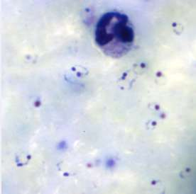 Parasitmorfologi UK Neqas Blodparasiter sept 2014 feb 2015 Mån Förväntat fynd Resultat Sep 3 Plasmodium malariae 20/22 Sep 30 Inget fynd