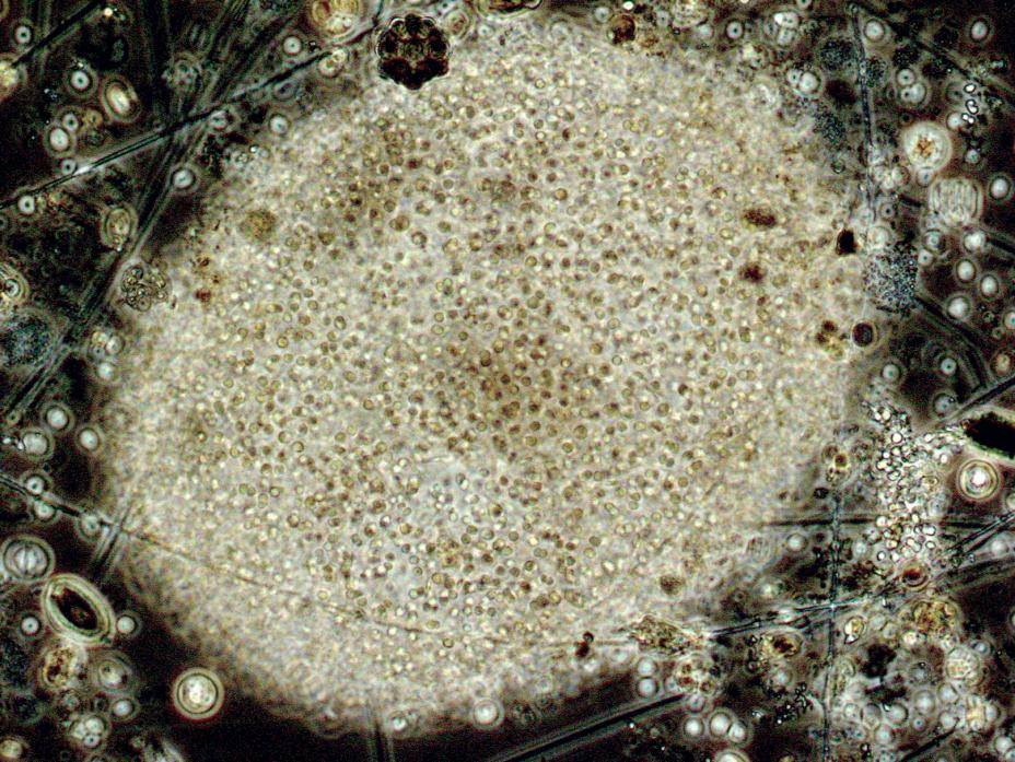 Cyanobakterien Microcystis flos-aquae är